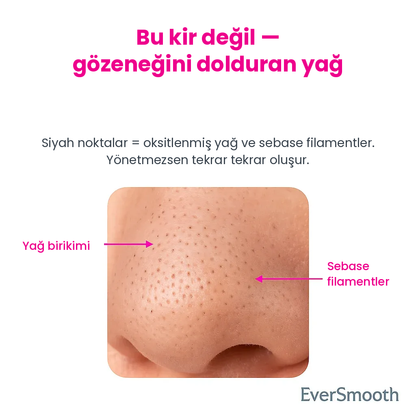 Pore Vio™ — Elektrikli Gözenek Temizleme Cihazı