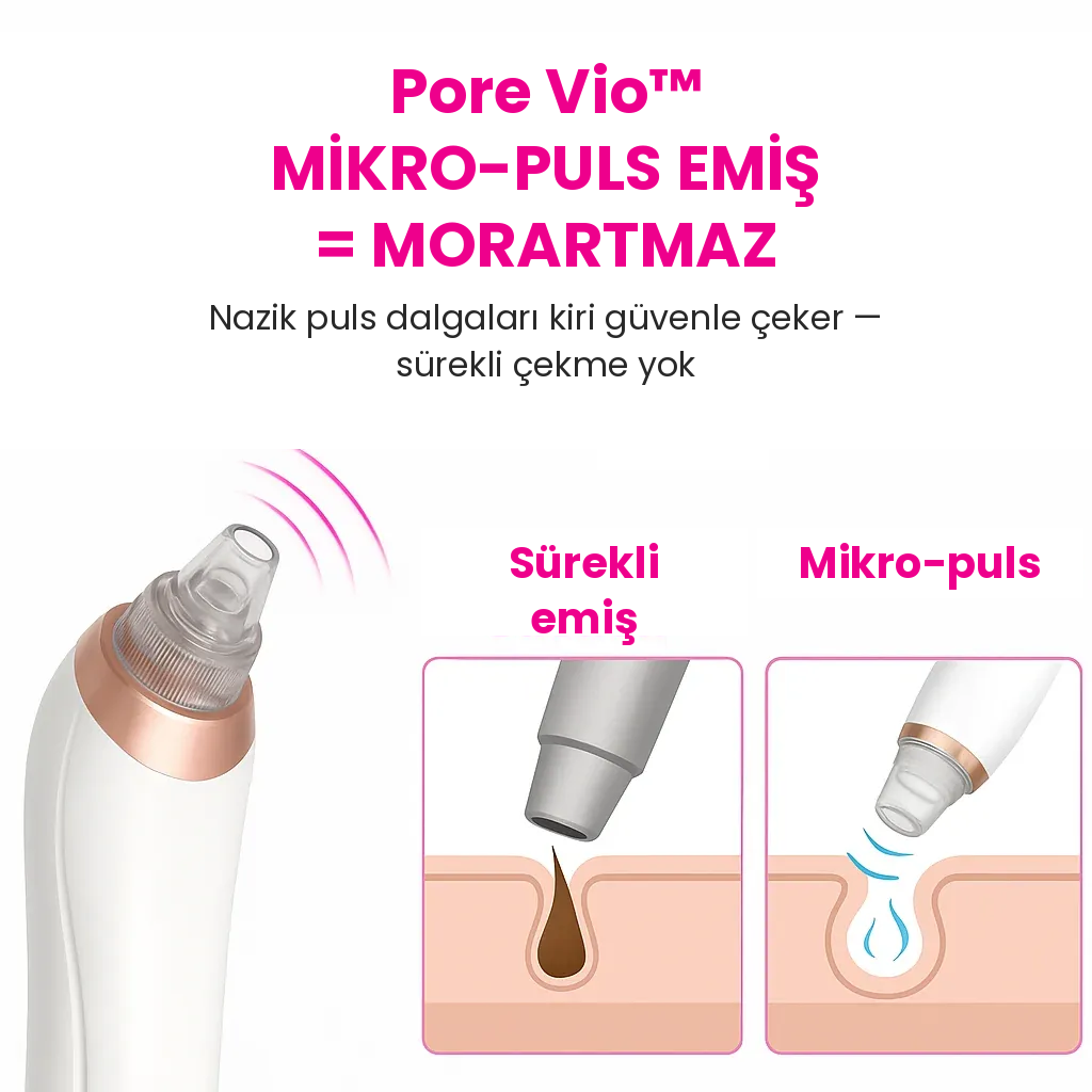 Pore Vio™ — Elektrikli Gözenek Temizleme Cihazı