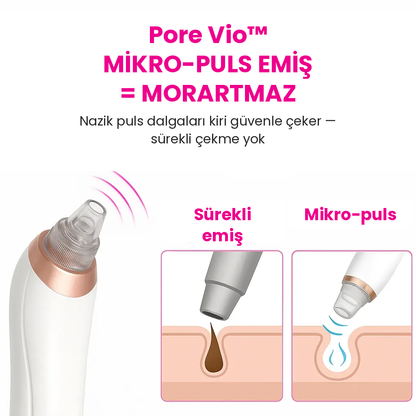 Pore Vio™ — Elektrikli Gözenek Temizleme Cihazı