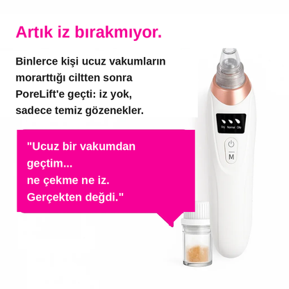 Pore Vio™ — Elektrikli Gözenek Temizleme Cihazı
